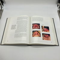 Primary Rhinoplasty: Logic & Techniques (1998) John Tebbetts 1e Hardcover Good